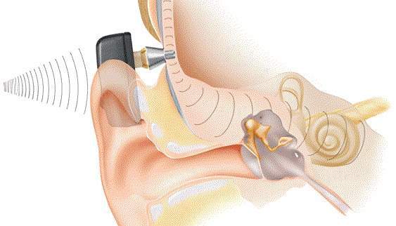 1 Picsart AiImageEnhancer