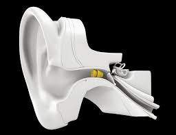 Lyric Phonak Béziers